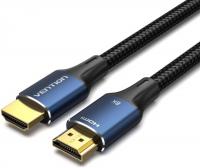 Кабель Vention ALGLI HDMI - HDMI (3 м, черный)